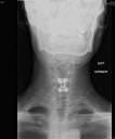 2008-05-23 AP XRay.jpg